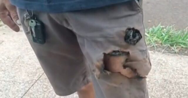 Braziliyada MARAQLI HADİSƏ: İtin dişlədiyi telefon partlayaraq sahibini XİLAS ETDİ – FOTO