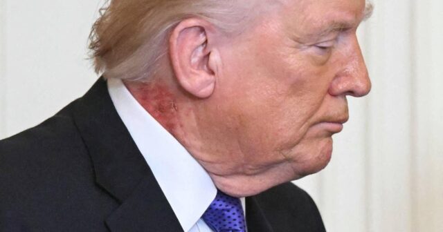 Trampın boynunda qəribə qırmızı ləkə MÜŞAHİDƏ EDİLDİ