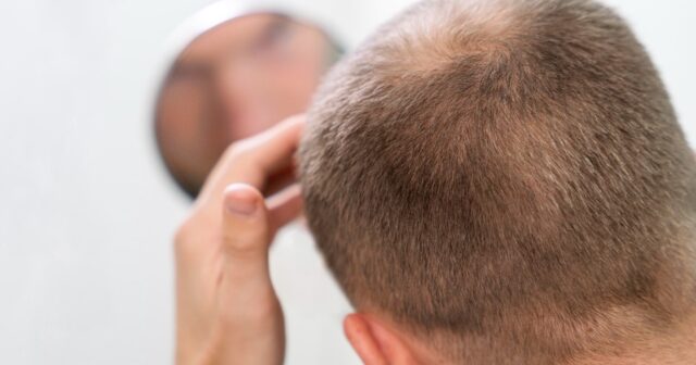 Kran suyu keçəlliyə SƏBƏB OLUR – Həkimlərdən CİDDİ XƏBƏRDARLIQ