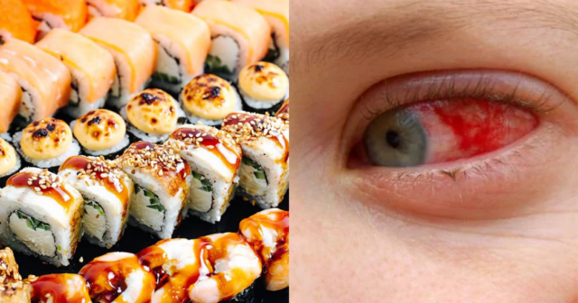 Suşi sevənlərə XƏBƏRDARLIQ: Yeni virus insanları KOR EDİR