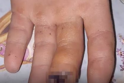 Elektrikli burğu məktəblinin barmağını DEŞİB KEÇDİ – VİDEO