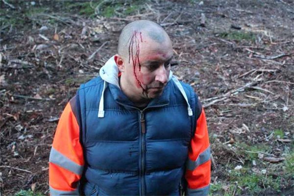 İsveç polisi azərbaycanlını döydü – FOTO