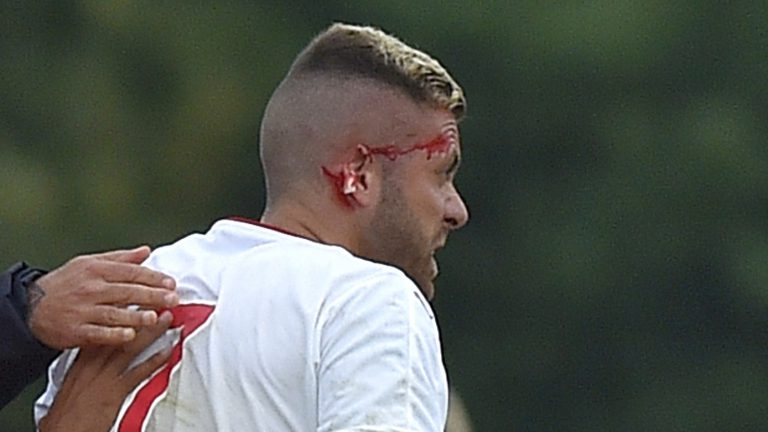 Futbolçunun meydanda qulağı qopdu