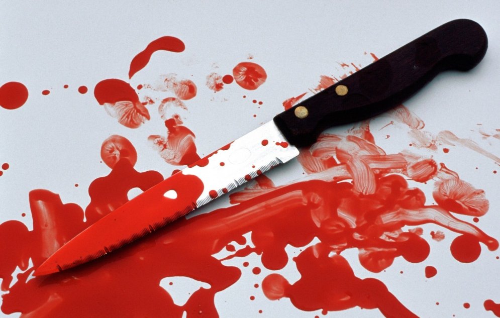 31 yaşlı qadın işlətdiyi kafedə bıçaqlandı