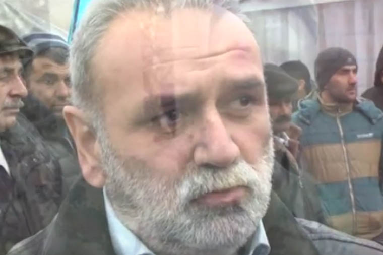 “Bu tək Çingizin qəhrəmanlığı deyil” — VİDEO