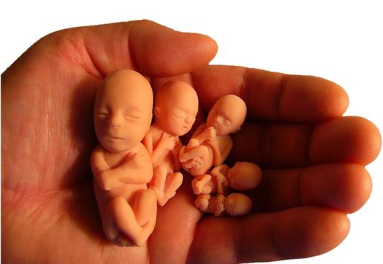 Qanunsuz abort edənləri 5 il həbs gözləyir