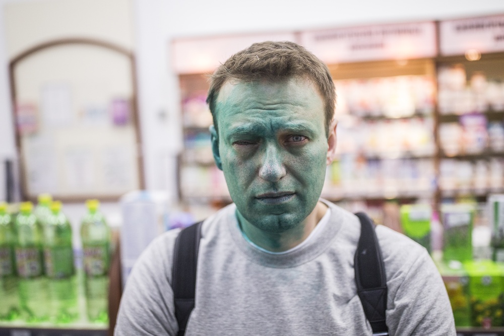 Aleksey Navalnıya hücum oldu – Üzünü boyadılar