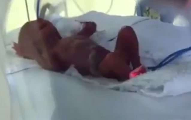 Bakıda çəkisi 370 qram olan uşaq doğuldu – Ailəsi yaşamasını istəmədi