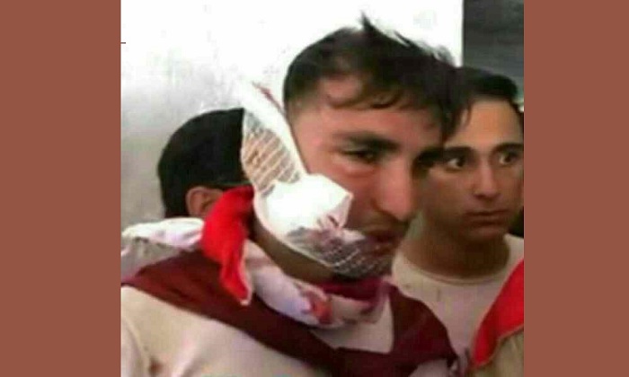 İranın paytaxtında azərbaycanlı azarkeşlər döyüldü – FOTO – VİDEO