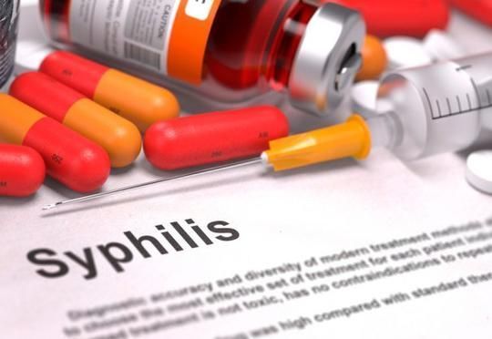 Sifilis xəstələrinin bölgələr üzrə sayı açıqlandı – STATİSTİKA