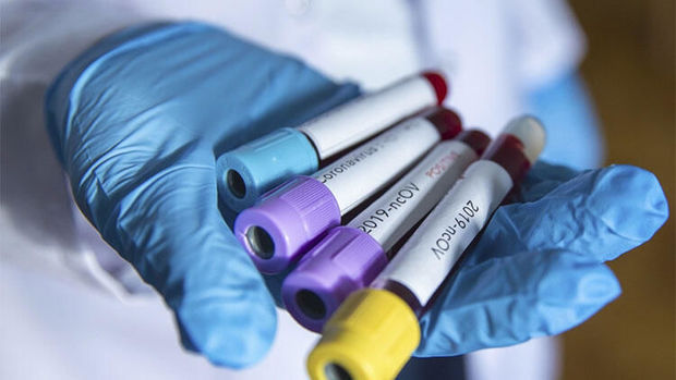 İranda iki nəfərdə koronavirus aşkarlandı