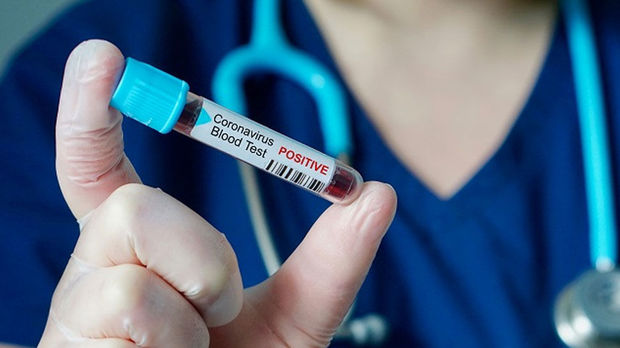 Belarusda ilk koronavirus halı – İnfeksiyaya yoluxan Bakıdan gedib
