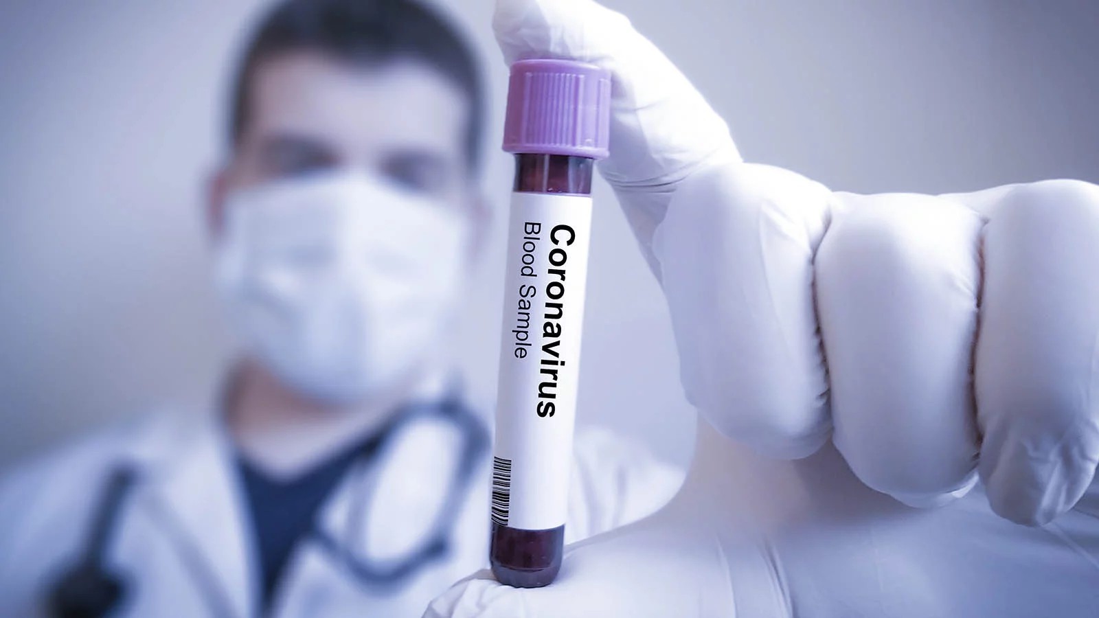Alimlər: “Siqaret çəkənlərin koronavirusa yoluxma riski azdır”