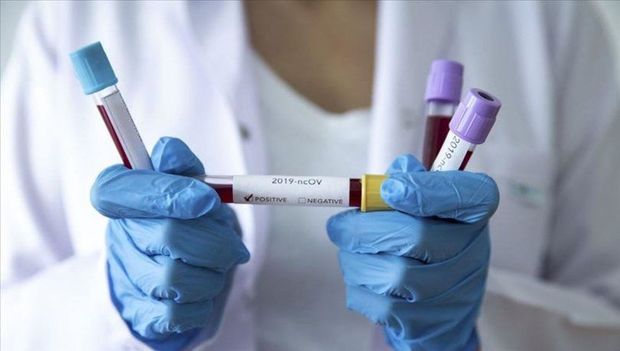 Koronavirusla bağlı son STATİSTİKA